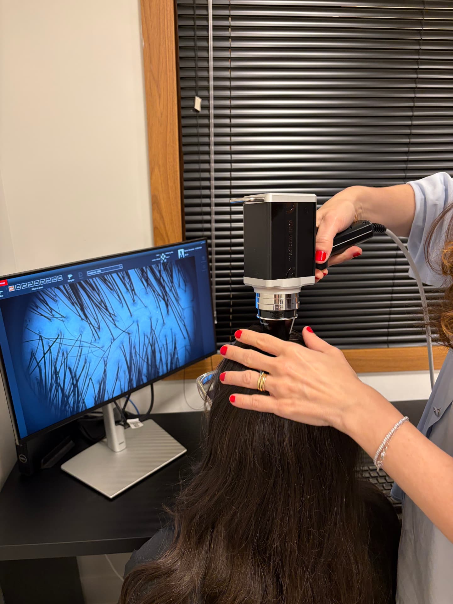 Exame de tricoscopia digital em andamento, com imagem ampliada do couro cabeludo exibida no monitor